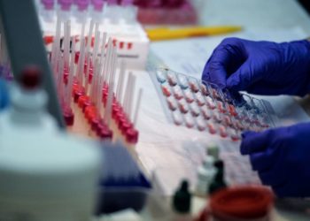 المانی بانک:  کرونا ویروس نړۍ ته د بیالوژیک پاسپورت د جوړېدو اړتیا پېښه کړې