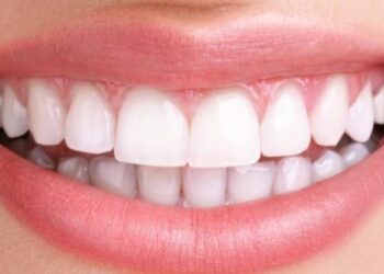 دغه کارونه مو غاښونه خرابوي