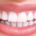 دغه کارونه مو غاښونه خرابوي