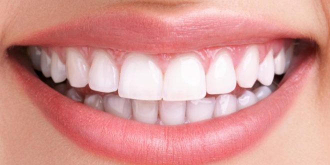 دغه کارونه مو غاښونه خرابوي