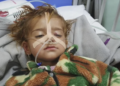 خوراځواکۍ او لوږې افغان ماشومان له مرګ سره مخ کړي