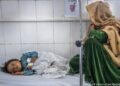 یونسیف: افغانستان کې له نیمایي ډېر ماشومان له خوارځواکۍ ځورېږي
