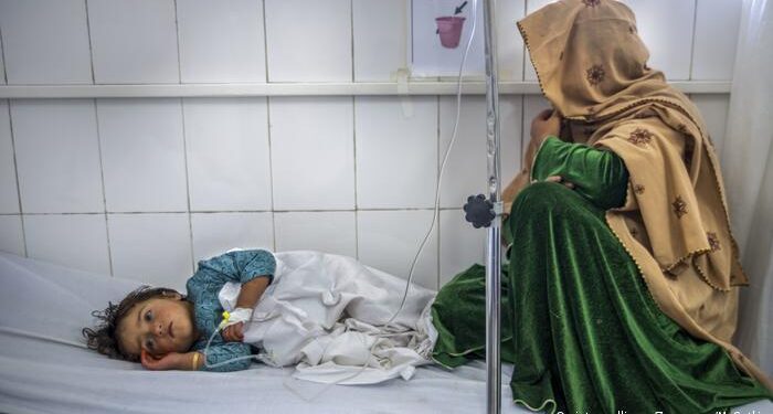 یونسیف: افغانستان کې له نیمایي ډېر ماشومان له خوارځواکۍ ځورېږي
