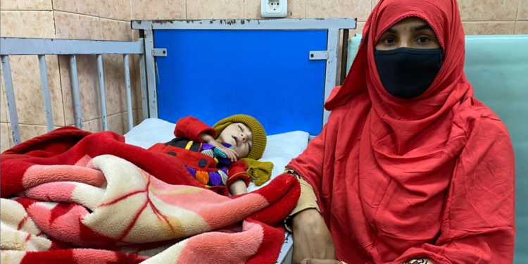 اوچا: افغانستان کې د خوارځواکۍ کچه خطرناک حالت ته رسېدلې