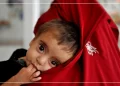 افغانستان کې پر خوارځواکۍ د اخته ماشومان درملنه زیاته شوې ده
