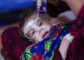 عامې روغتیا وزارت: ۲۰۰ زره ماشومان په موسمي ناروغیو اخته شوي