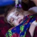 عامې روغتیا وزارت: ۲۰۰ زره ماشومان په موسمي ناروغیو اخته شوي