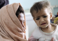 نږدې ۹۰۰ زره افغان ماشومان له سختې خوارځواکۍ سره مخ دي