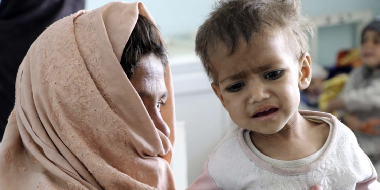 نږدې ۹۰۰ زره افغان ماشومان له سختې خوارځواکۍ سره مخ دي