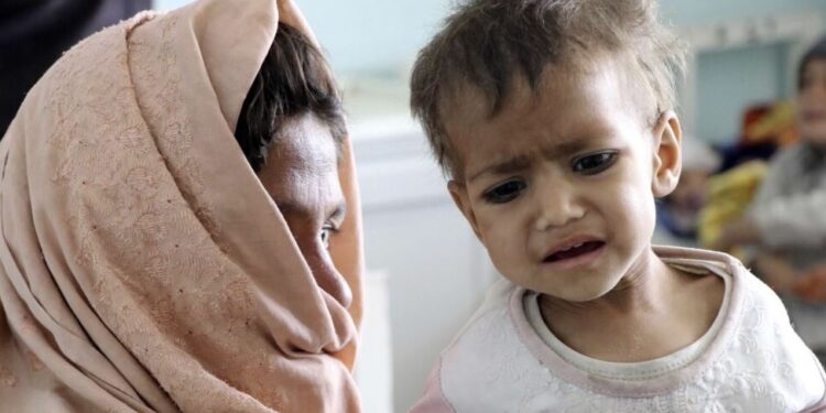یونېسف: ۸ لکه۵۷ زره ماشومان له شدېدې خوارځواکۍ سره مخامخ دي