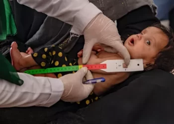کندهار کې په سختې خوارځواکۍ د ۱۷ زرو اخته ماشومانو درملنه شوې