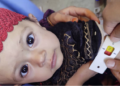 اروزګان کې ۱۲ زره ماشومان په خوارځواکۍ اخته شوي