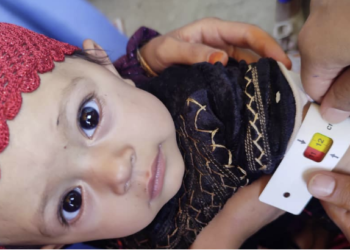اروزګان کې ۱۲ زره ماشومان په خوارځواکۍ اخته شوي