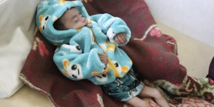 بدخشان کې په خوارځواکۍ اخته ۲۶ماشومان مړه شوي