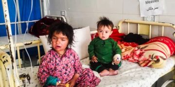 هلمند؛ سږ کال په شري ناروغۍ د اخته ماشومانو شمېر زیات شوی