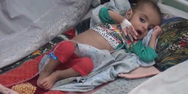 بغلان کې د څه باندې ۴۲ زره پر خوارځواکۍ اخته ماشومانو درملنه شوې
