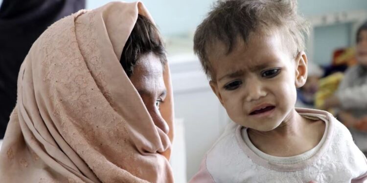 وېژن نړیوال سازمان: افغانستان د شدیدې خوارځواکۍ په برخه کې څلورم هېواد دی