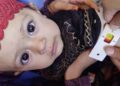 په هیواد کې ۳ میلیونه ماشومان او ښځې پر خوارځواکۍ اخته دي