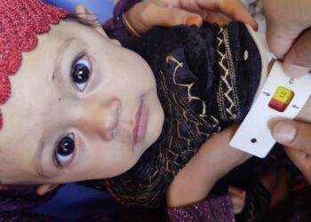 په هیواد کې ۳ میلیونه ماشومان او ښځې پر خوارځواکۍ اخته دي