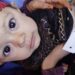 په هیواد کې ۳ میلیونه ماشومان او ښځې پر خوارځواکۍ اخته دي